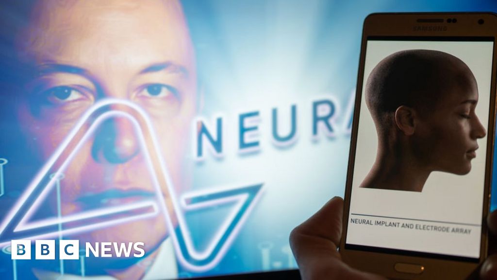 Elon Musk\'s Neuralink implants brain chip in first human patient