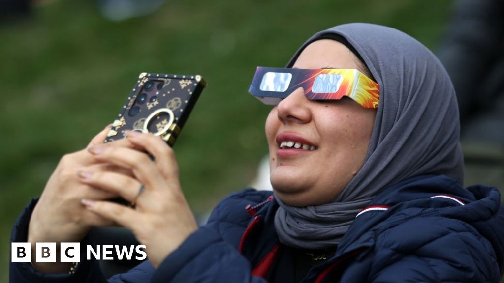 What to do if your eyes hurt after the eclipse