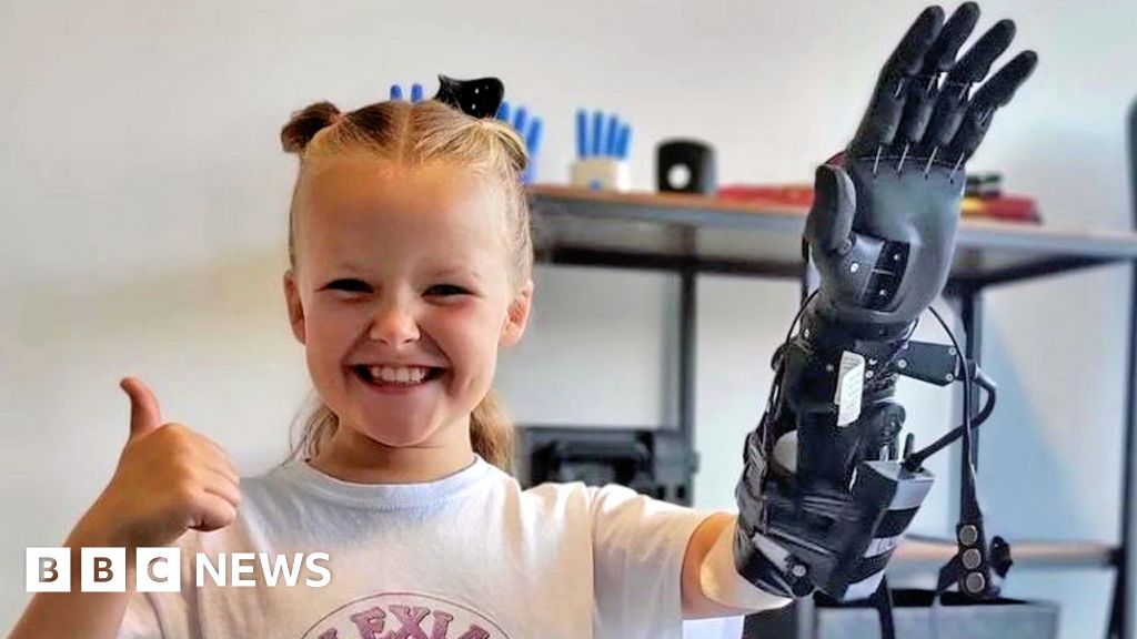 Children with limb difference to get ‘life-changing’ prosthetic arms