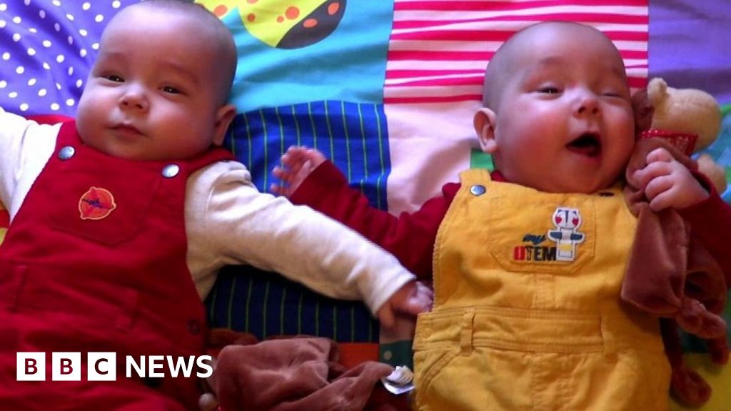 Unique bond of twins who cuddled in womb BBC News