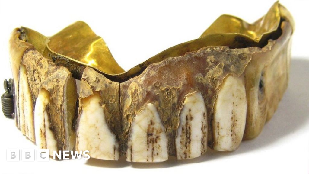 Ivory and gold false teeth found in field up for sale at auction