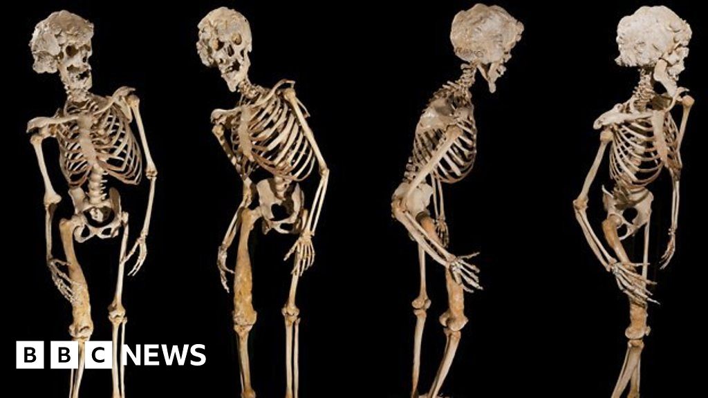 Elephant Man Joseph Merrick 'should be given burial' BBC News
