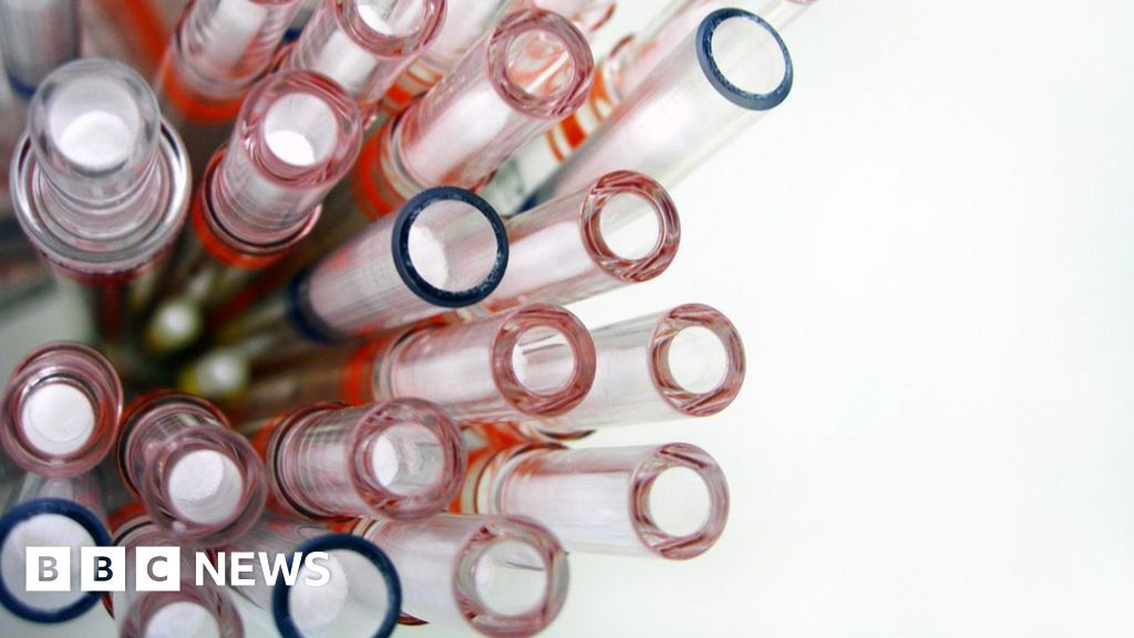 Genetic tests: Experts urge caution over home testing