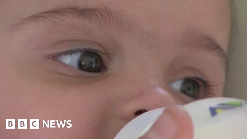 'My baby is allergic to milk' - BBC News
