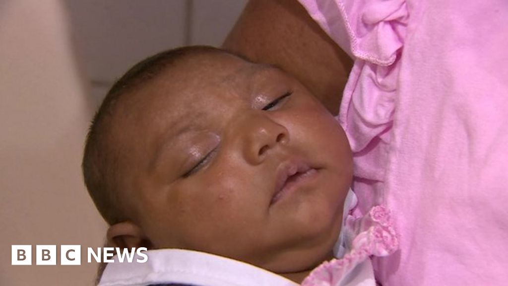 World Health Organisation Warns Zika Could Infect Four Million Bbc News