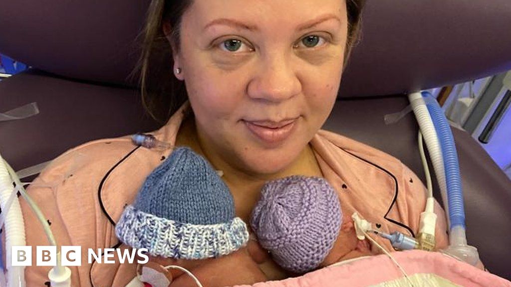 Twin thought to be UK's most premature to survive goes home