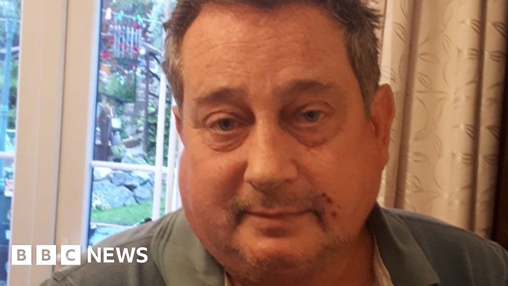 Man With Incurable Cancer Has Benefits Stopped man-with-incurable-cancer-has-benefits-stopped