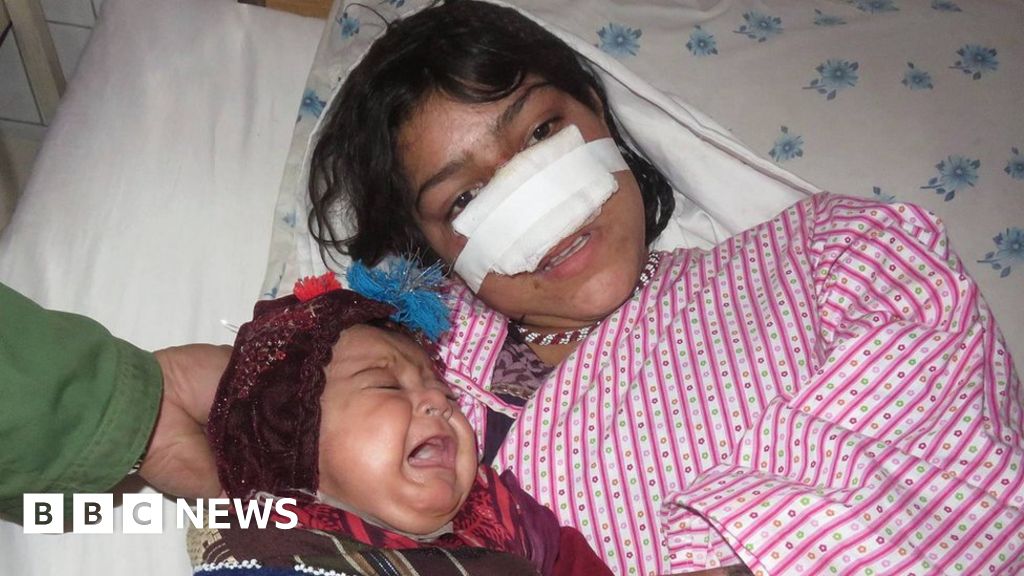 Reza Gul The Afghan Woman Whose Husband Cut Off Her Nose Bbc News