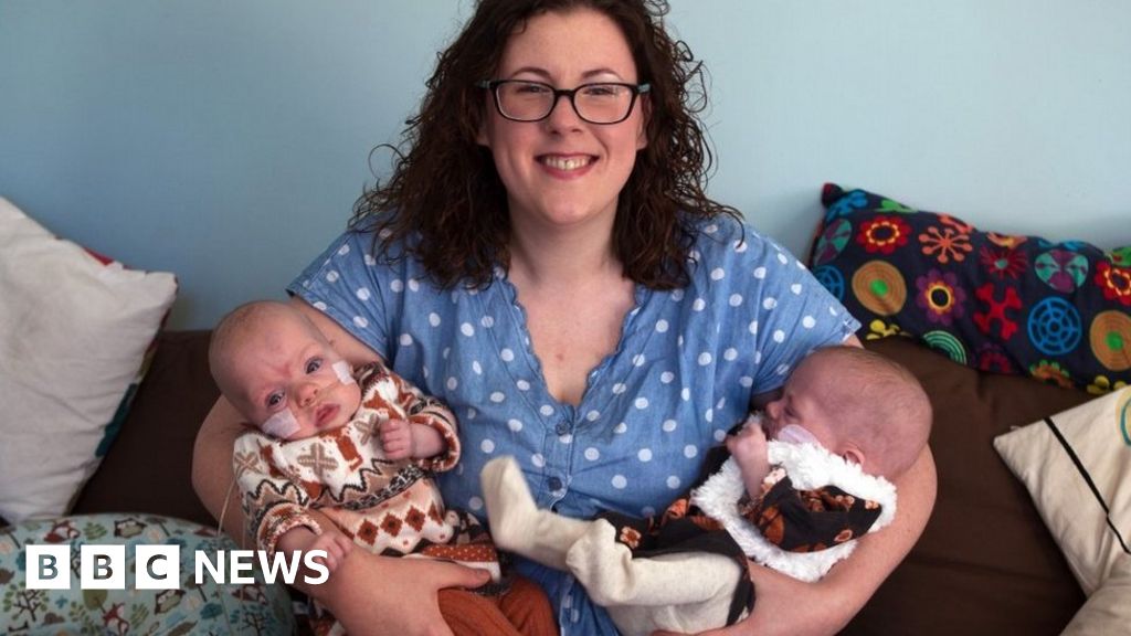 Twins Born At 23 Weeks Are Little Miracles c News