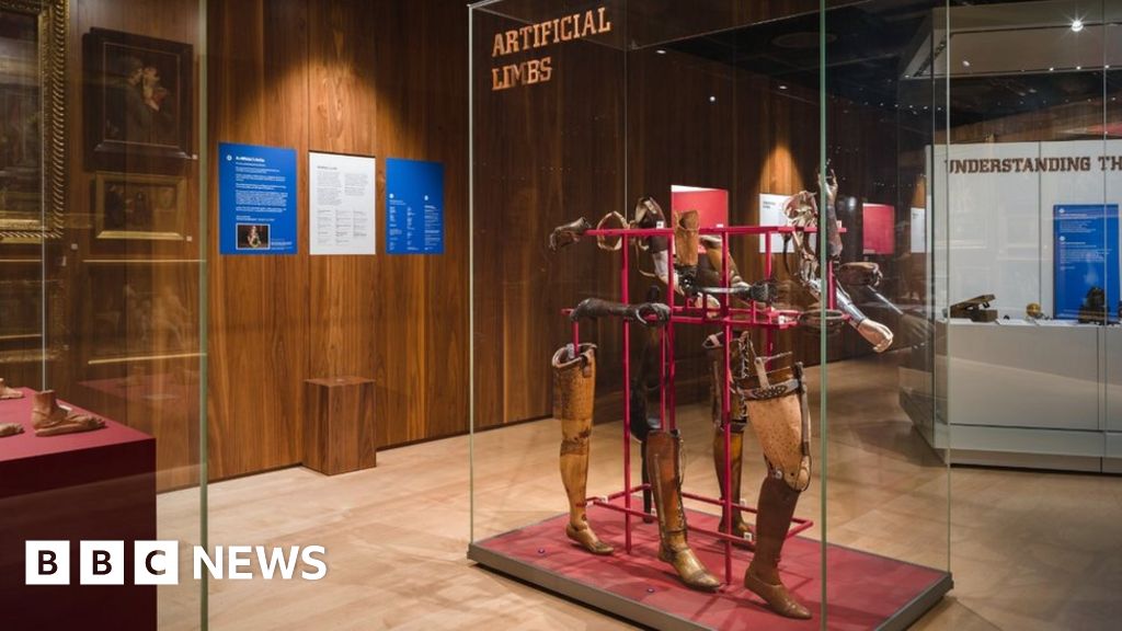 Wellcome Collection closes 'racist, sexist and ableist' Medicine Man display