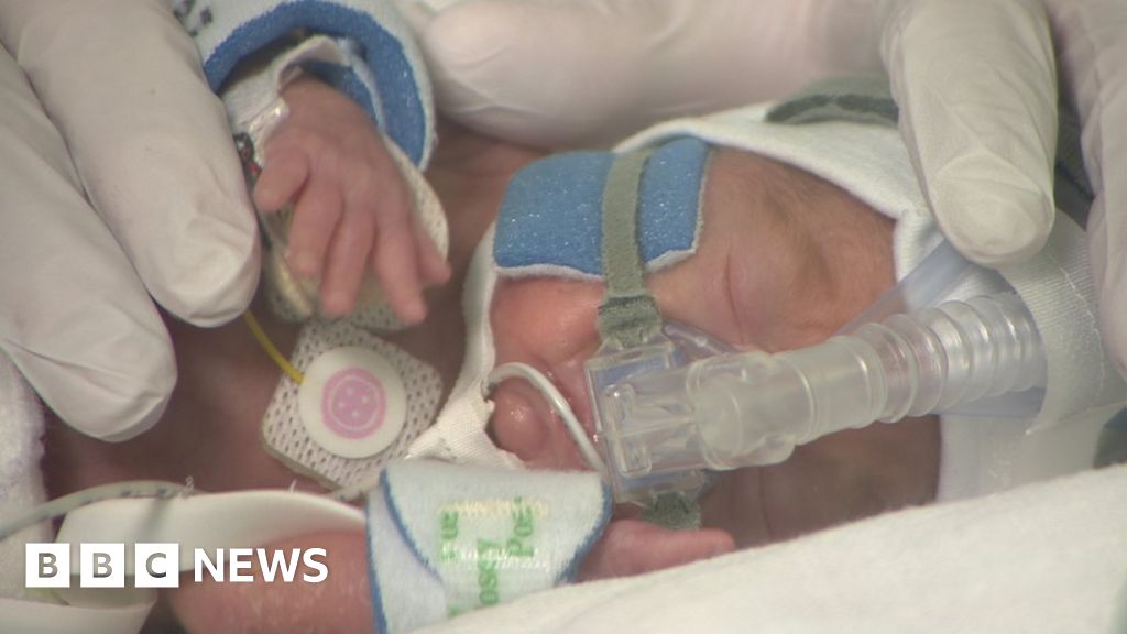 'Breakthrough' lung treatment saving premature babies BBC News