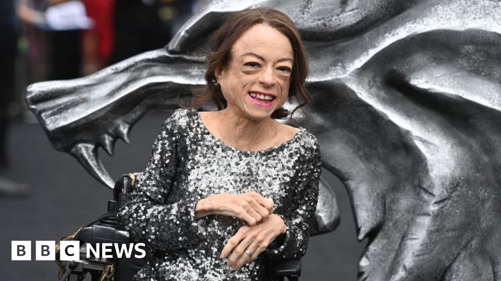 Assisted dying debate terrifying for disabled, says Liz Carr