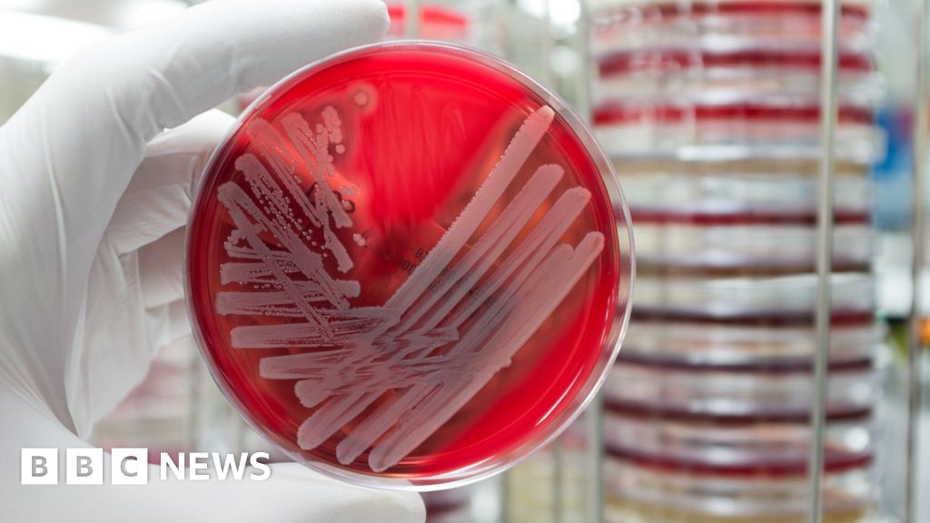 Superbug 'sleuthing' finds secret outbreaks