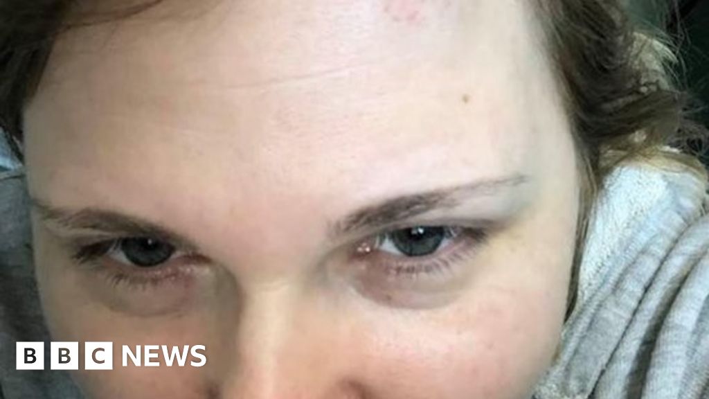 Russian reporter Milashina, who exposed Chechen gay purge, attacked in Grozny