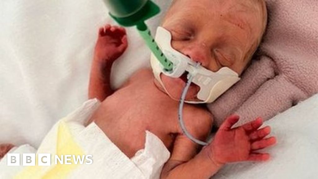 Baby born 16 weeks early on holiday flown home to Devon BBC News