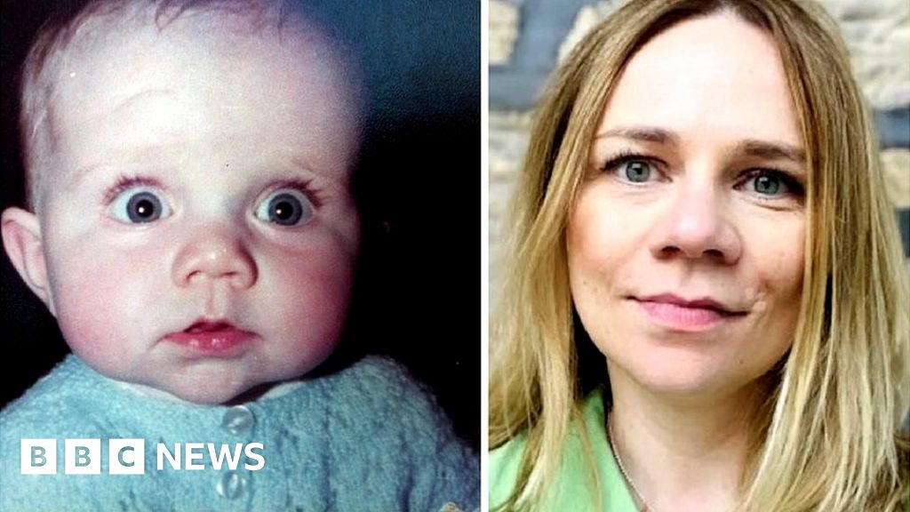 I was the first baby in the world to get a pacemaker BBC Dr. Lex