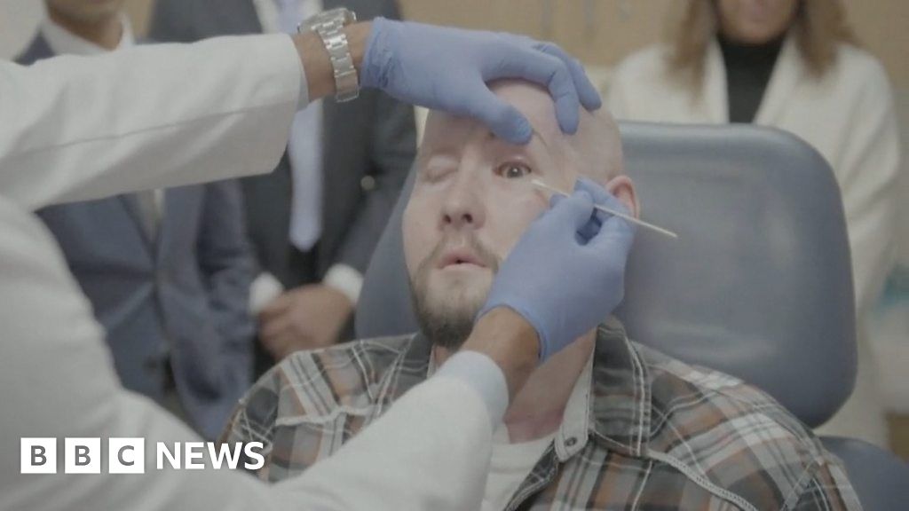 Arkansas man receives world's first eye transplant