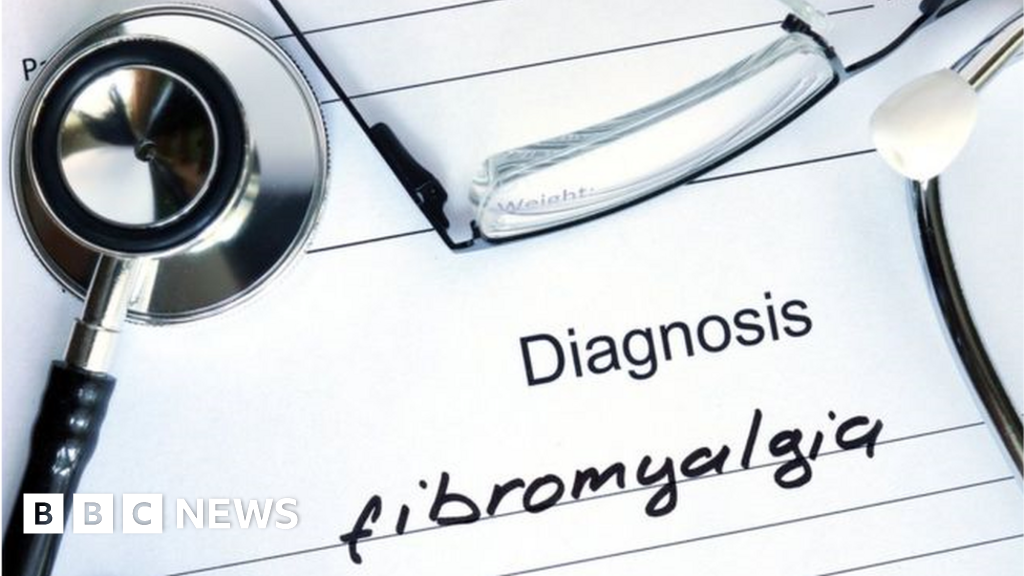 Fibromyalgia may affect as many as one in 25 people in NI