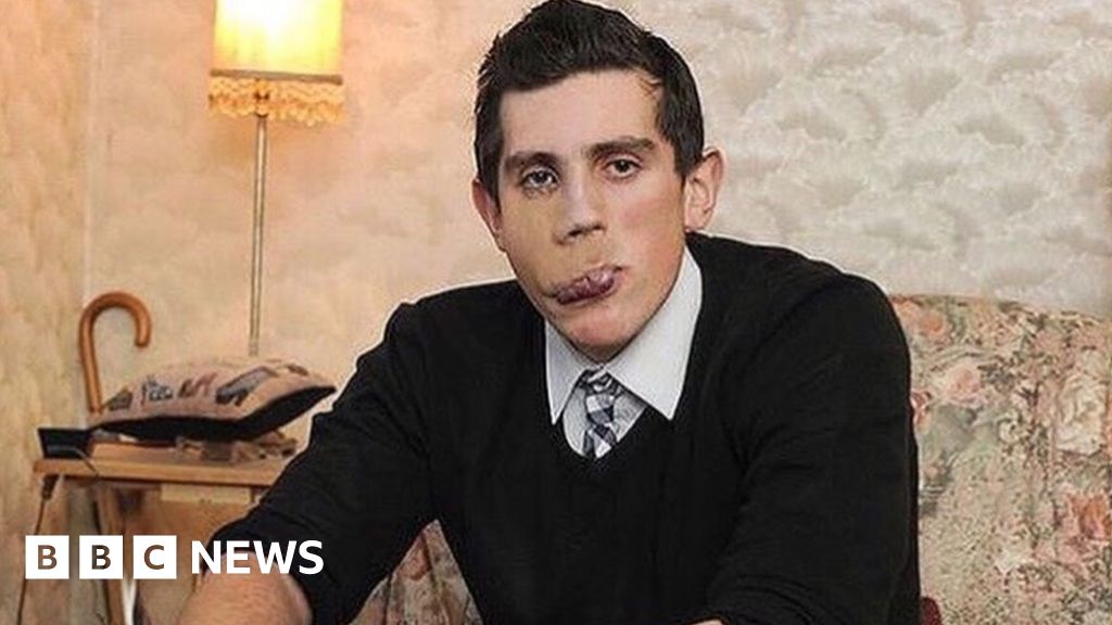 'People stared and laughed and I don't want others to go through that' BBC News