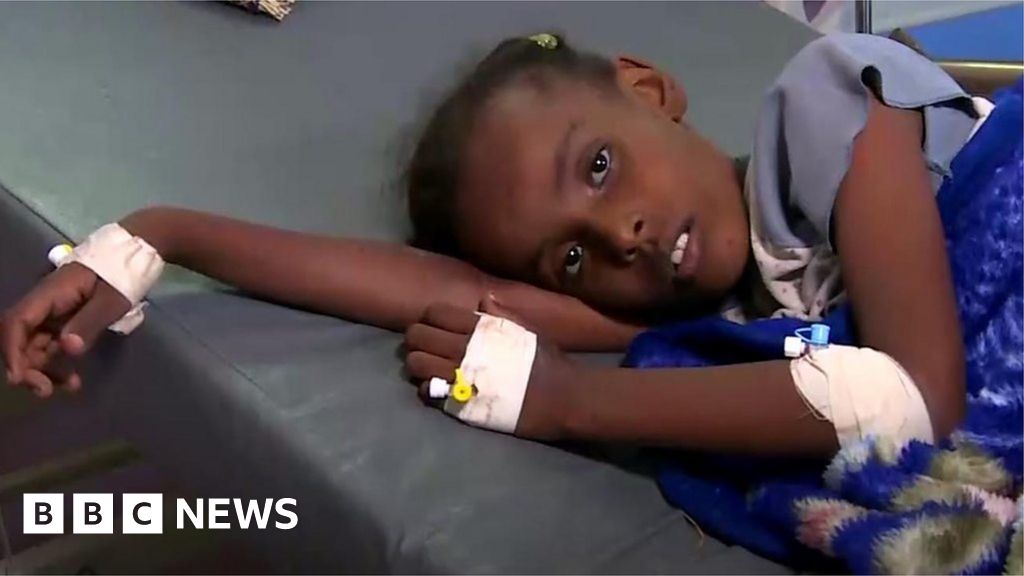 Yemen Faces Significant Cholera Outbreak Says Un Bbc News