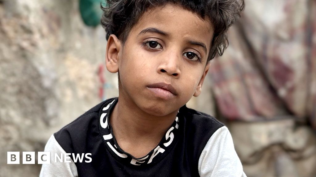 The children left injured and starving in Yemen's forgotten war