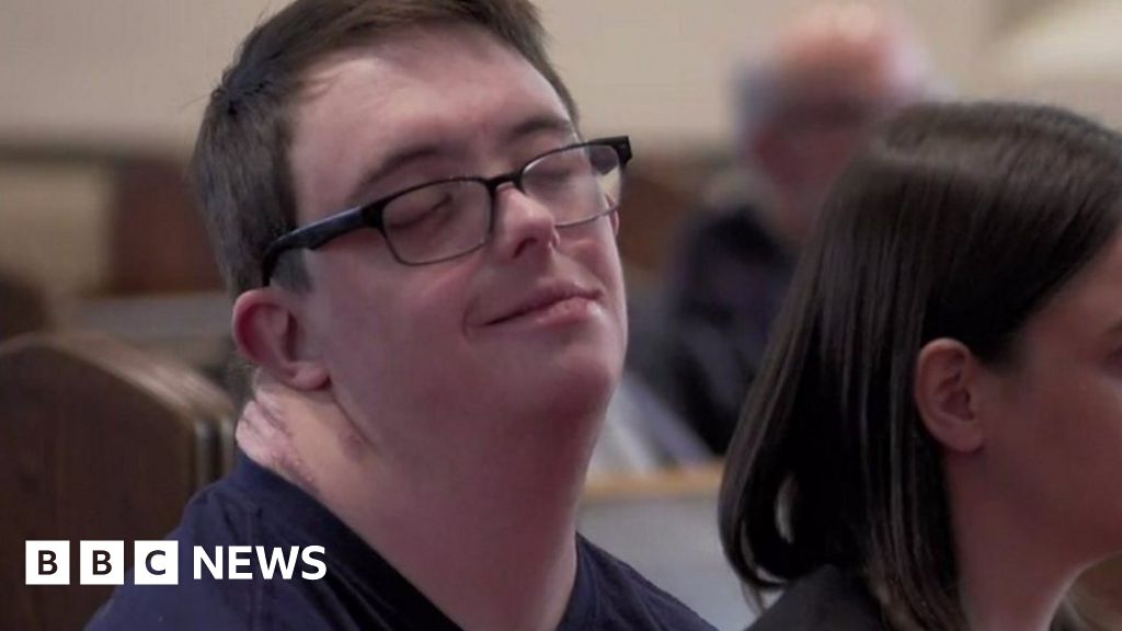 Thriving with Down's syndrome: Life as Jamie Knows It - BBC News