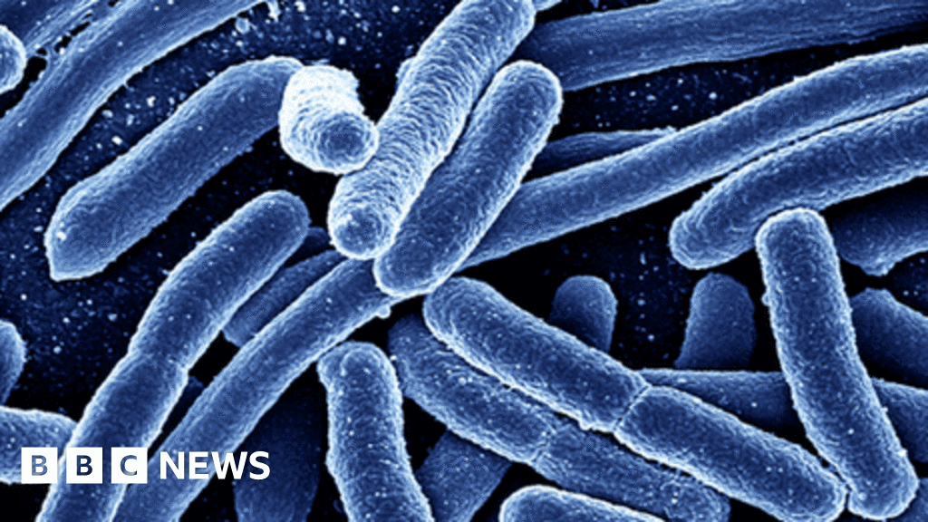 Pejabat Kanada sedang menyelidiki wabah E. coli di pusat penitipan anak di Calgary