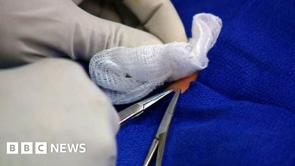 Italy Home Circumcision Kills Child Bbc News