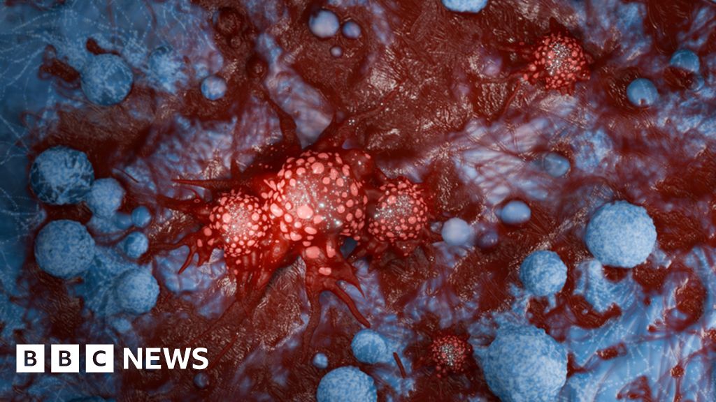 Dissociative identity disorder visual data 5