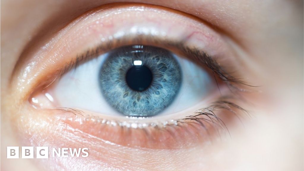 Brexit: Does Brussels blink?