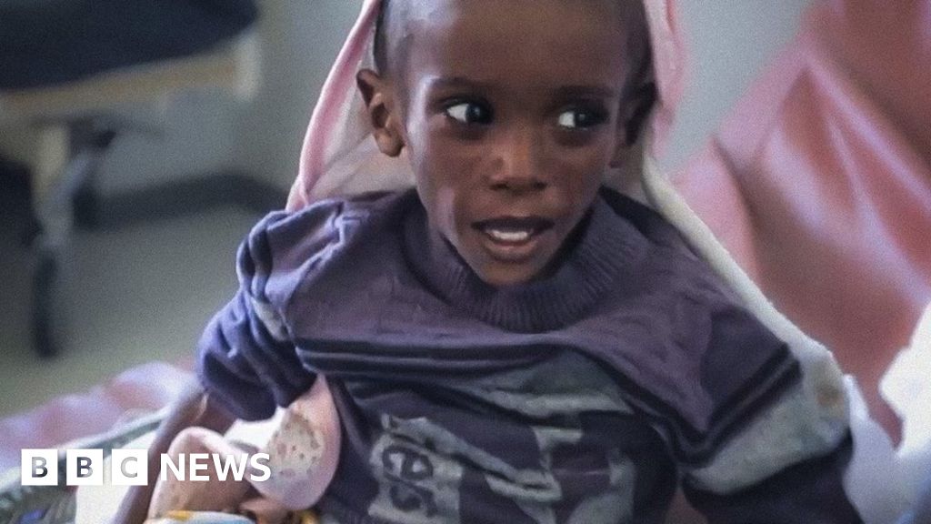 Ethiopia civil war: The boy named ‘Wealthy’ who weighs half what he should