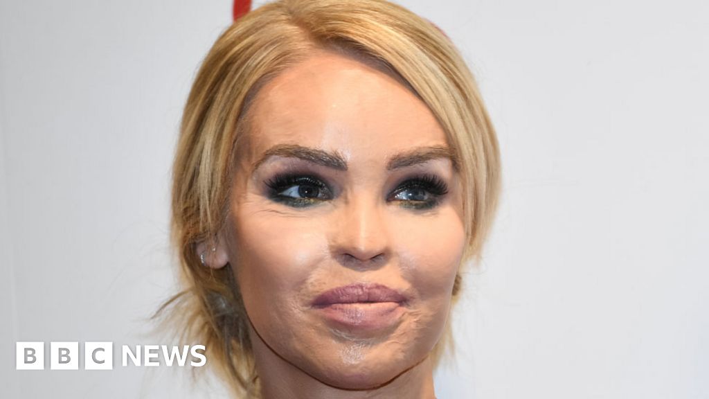 Katie Piper Trying To Deal With Acid Attacker Release Bbc News