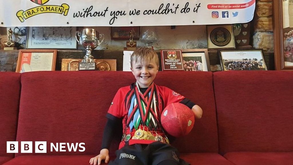 One-armed rugby player Shay Dunster, proves the bullies wrong