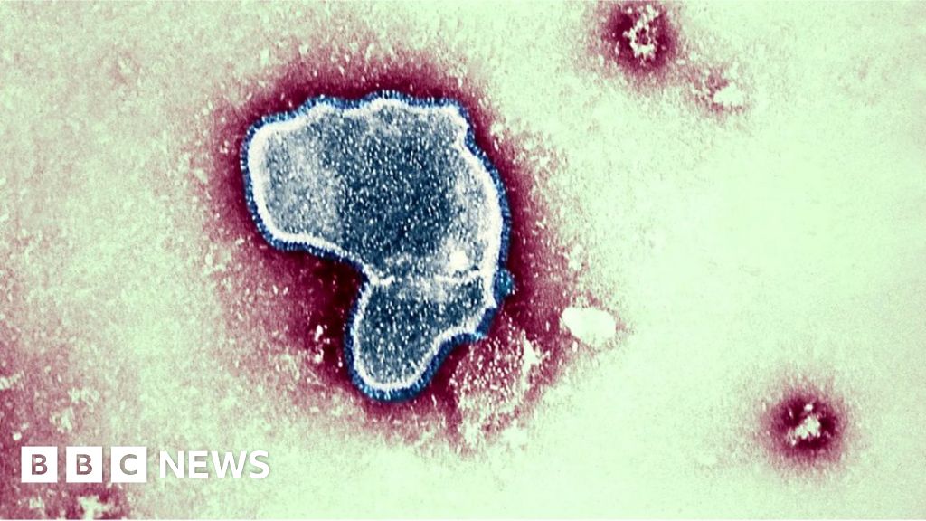 Cold virus killed 100,000 children globally in 2019 - BBC