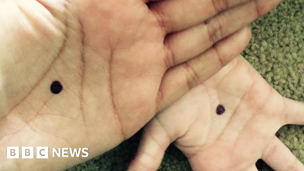 Can A Black Dot On A Victim S Hand Help Tackle Domestic Violence c News