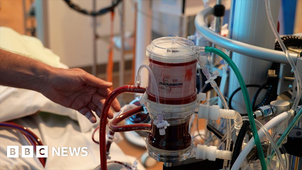 Covid19 The machine that breathes for Covid patients BBC News