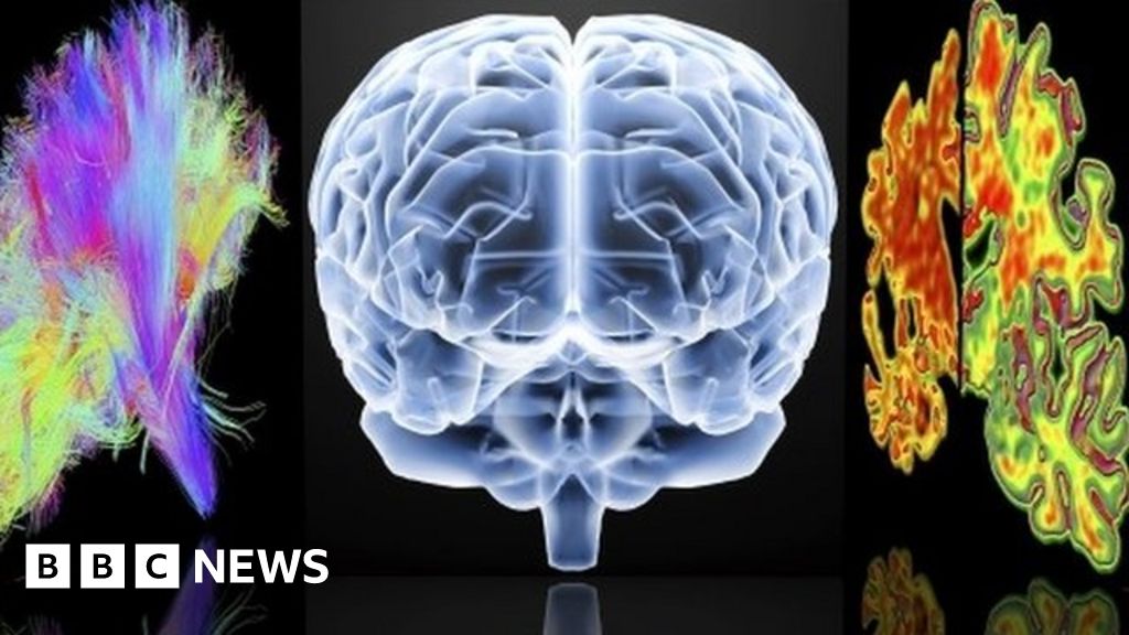 Dementia information for over 40s to be given by GPs BBC News