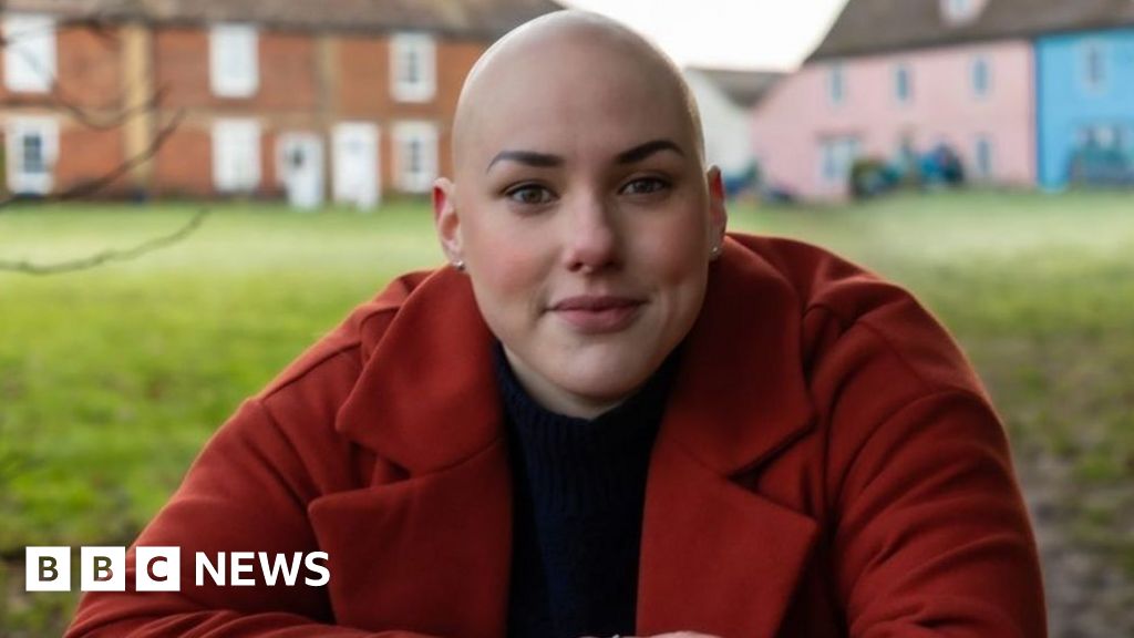 Alopecia: 'I'm ditching my wig in public after Oscars row'