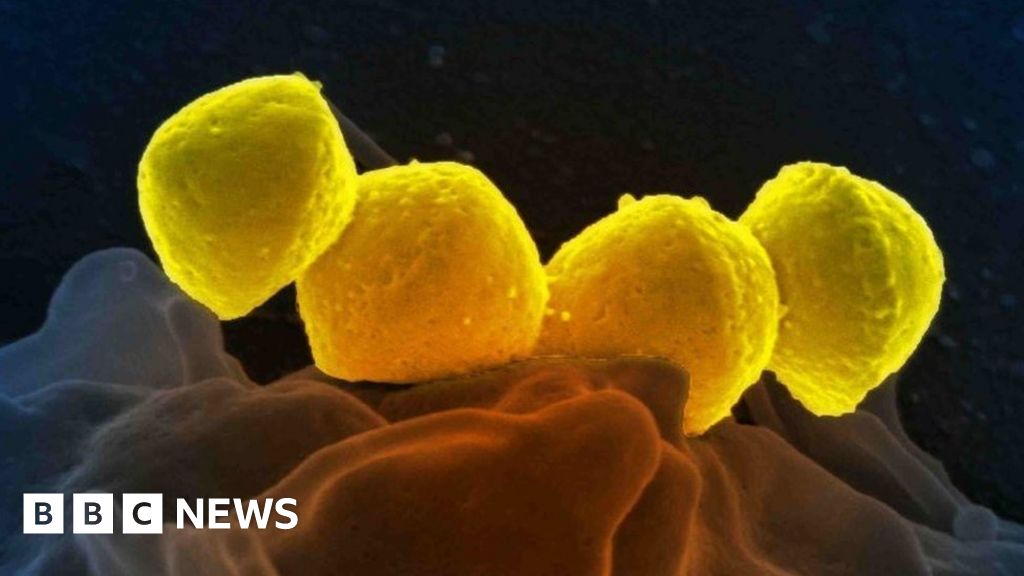 Strep A: University of Bristol study to aid hopes of vaccine