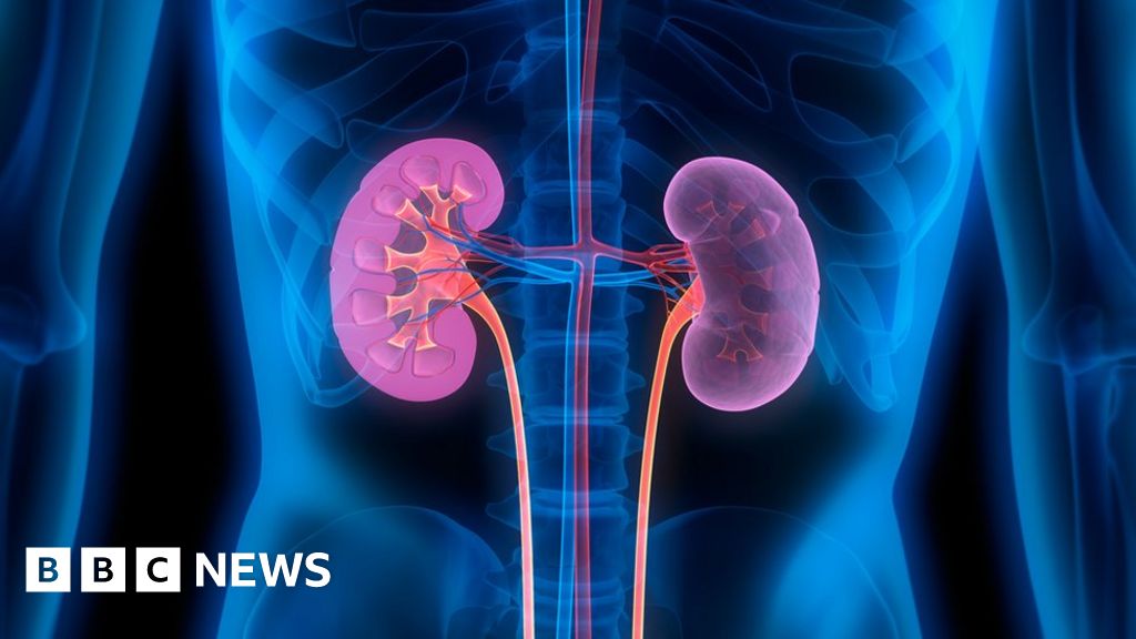 How an economist helped thousands get a new kidney
