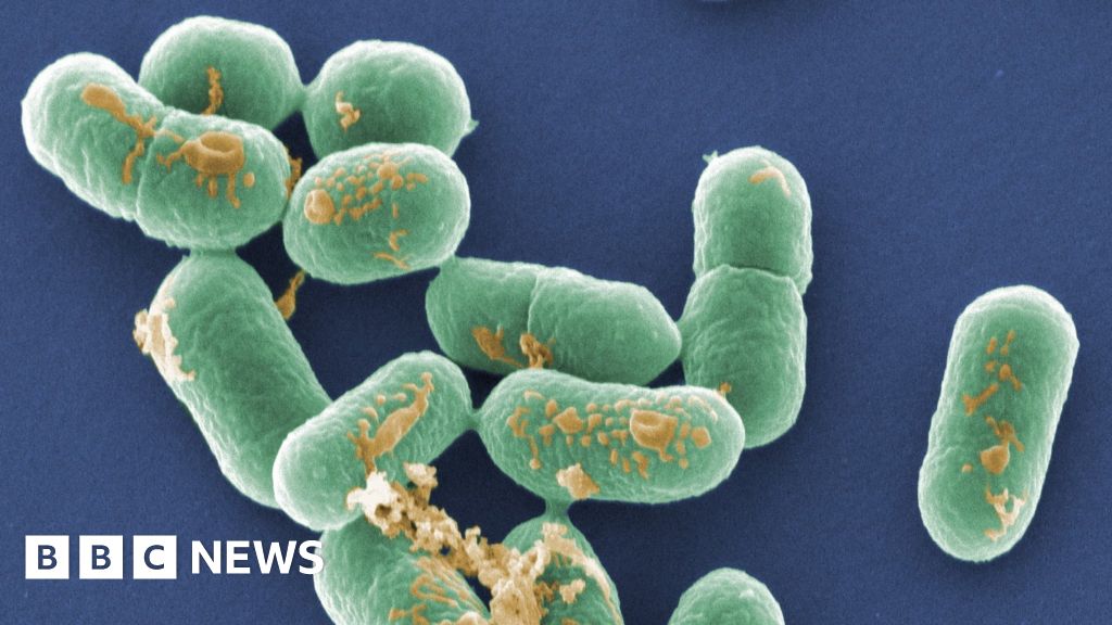 South Africa Listeria Source Of Worlds Worst Outbreak Found