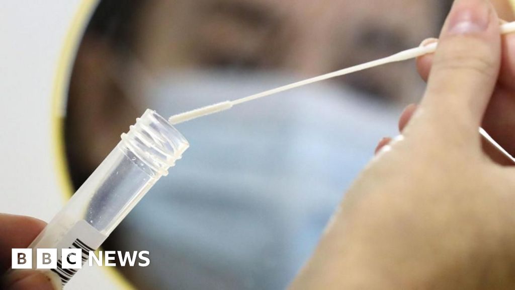 Newcastle sexual health service needs 'a lot of work' to rebuild