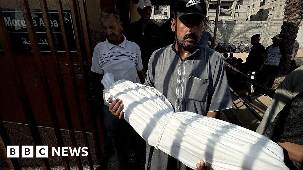 Gaza well being ministry says 33 folks died from malnutrition in 48 hours