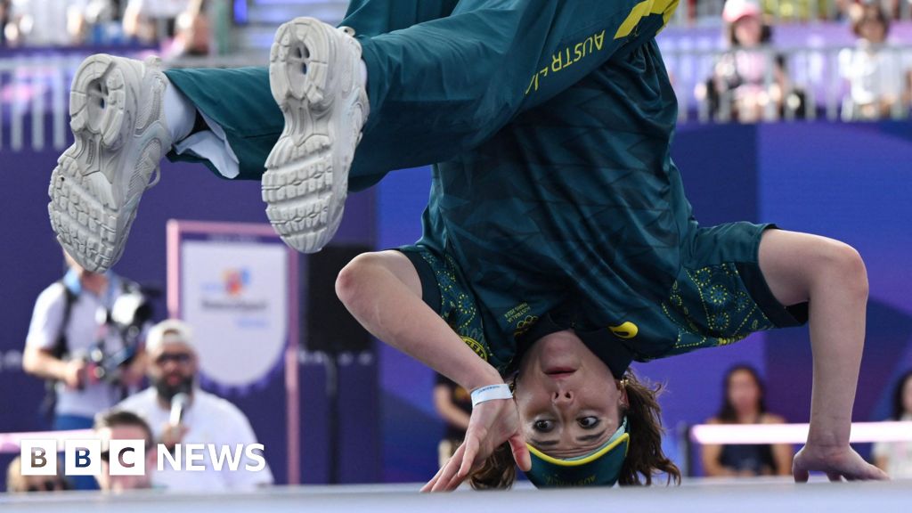 Breakdancers warned of cone-shaped lump from 'extensive headspinning'