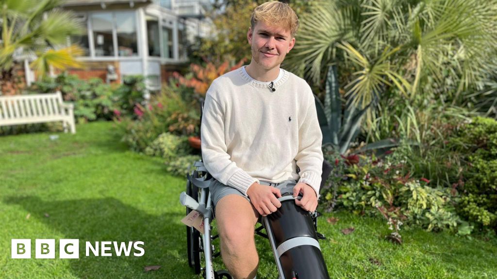 Amputee sharing story online is 'recovering well'