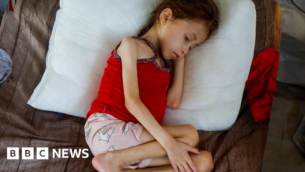 MPs call on government to bring sick and injured Gaza children to UK thumbnail