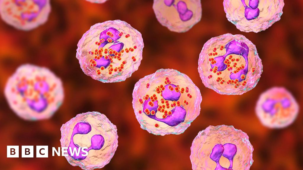 One dead and two ill after meningitis cases