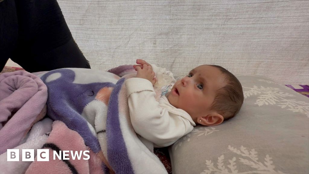 Gaza baby sent back to war zone after open-heart surgery in Jordan