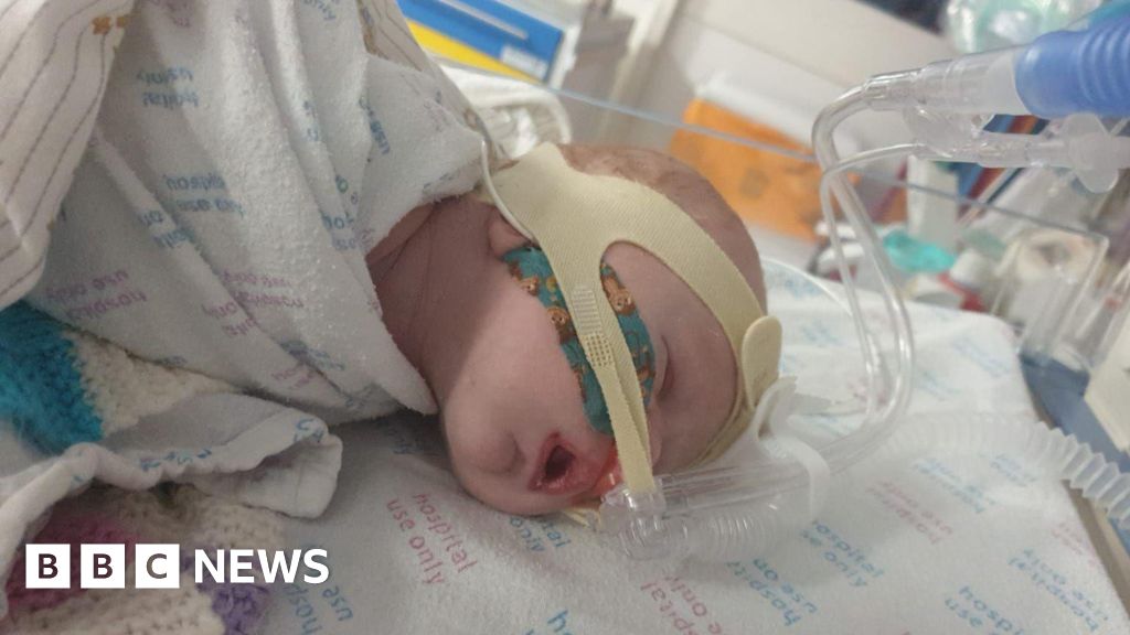 Mother warns after baby nearly dies from virus