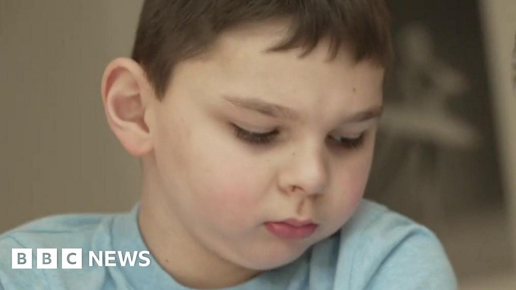 Tony Hudgell: Campaigning Boy Has Life-changing Surgery - BBC News